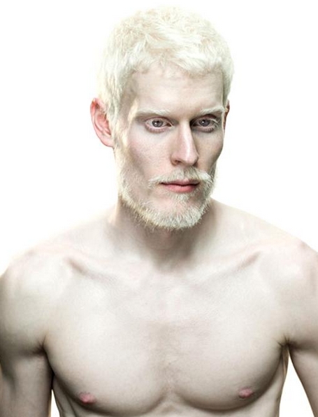 albino_male.jpg